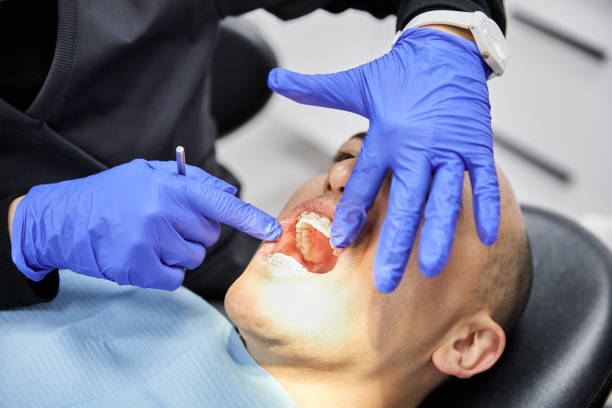Best Emergency Dentist for Lost Fillings or Crowns in Derwood, MD